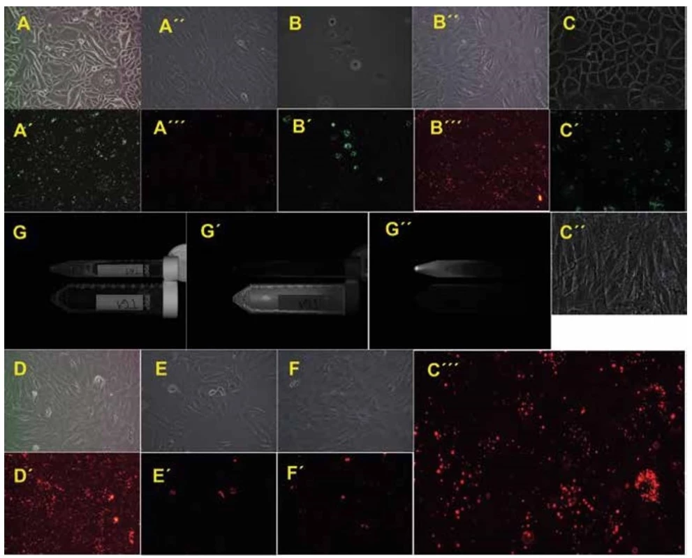 Primary oral keratinocytes and mesenchymal stem cells on the cultivation plastic or in cell suspension just before
transplantation<br>
Phase contrast or fluorescence microscopy of primary oral keratinocytes from pig L139 (A or A´, 100x magnification), L531 (B or B´,
100x magnification) and T61 (C or C´, 200x magnification). Phase contrast or fluorescence microscopy of mesenchymal stem cells
from pig L139 (A´´ or A´´´, 100x magnification), L531 (B´´ or B´´´, 100x magnification), T61 (C´´ or C´´´, 200x magnification), T79 (D or
D´, 100x magnification), T67 (E or E´, 100x magnification) and T83 (F or F´, 100x magnification). Primary cell suspensions of animal
T61 prior to transplantation: bright field of MSCs and pOKs in both falcons (G), Cy3 fluorescence of mesenchymal stem cells in 50ml
falcon (G´), FITC fluorescence of labelled primary oral keratinocytes in 15ml falcon (G´´), images acquisition by the ChemiDoc™
XRS+ System.
