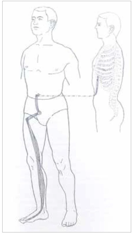 Šľachovo-svalová dráha
sleziny<br>
Fig. 7. Tendon-muscle path of the
spleen