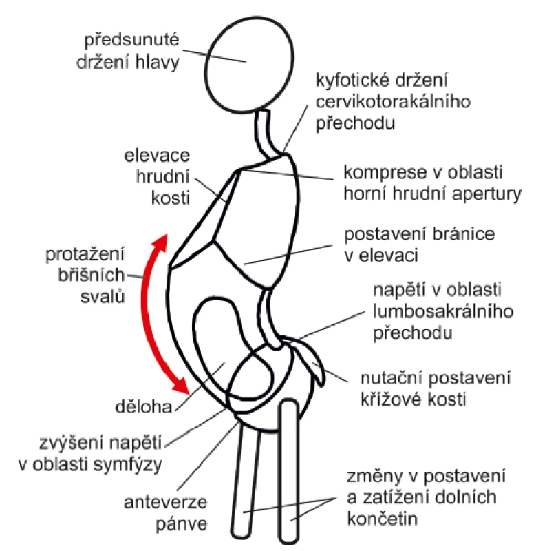 Posturální změny v těhotenství