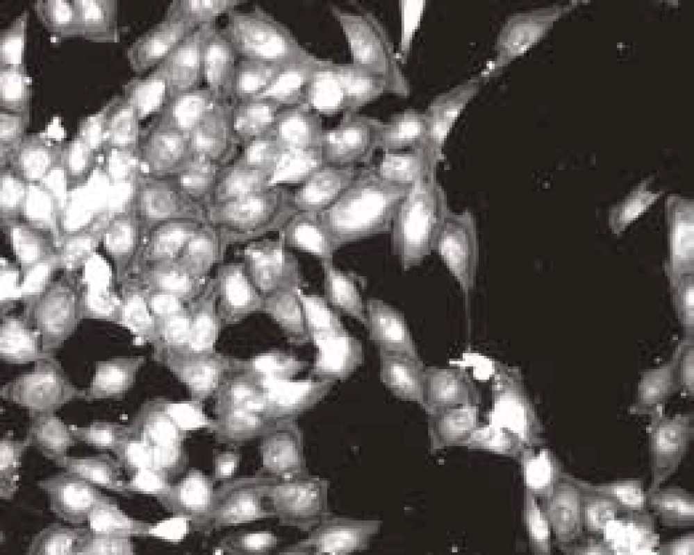 Buňky MG63 na povrchu
vzorku obarvené
fluoresceinem, jedno
hodnocené obrazové pole<br>
Fig. 4
The MG63 cells,
colored by fluorescein,
on the surface of the sample,
one of the analyzed fields