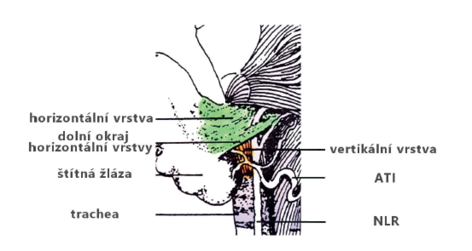Horizontální a vertikální vrstvy ligamenta Berry<br>
Fig. 6: The horizontal and vertical layers of the ligament
of Berry
