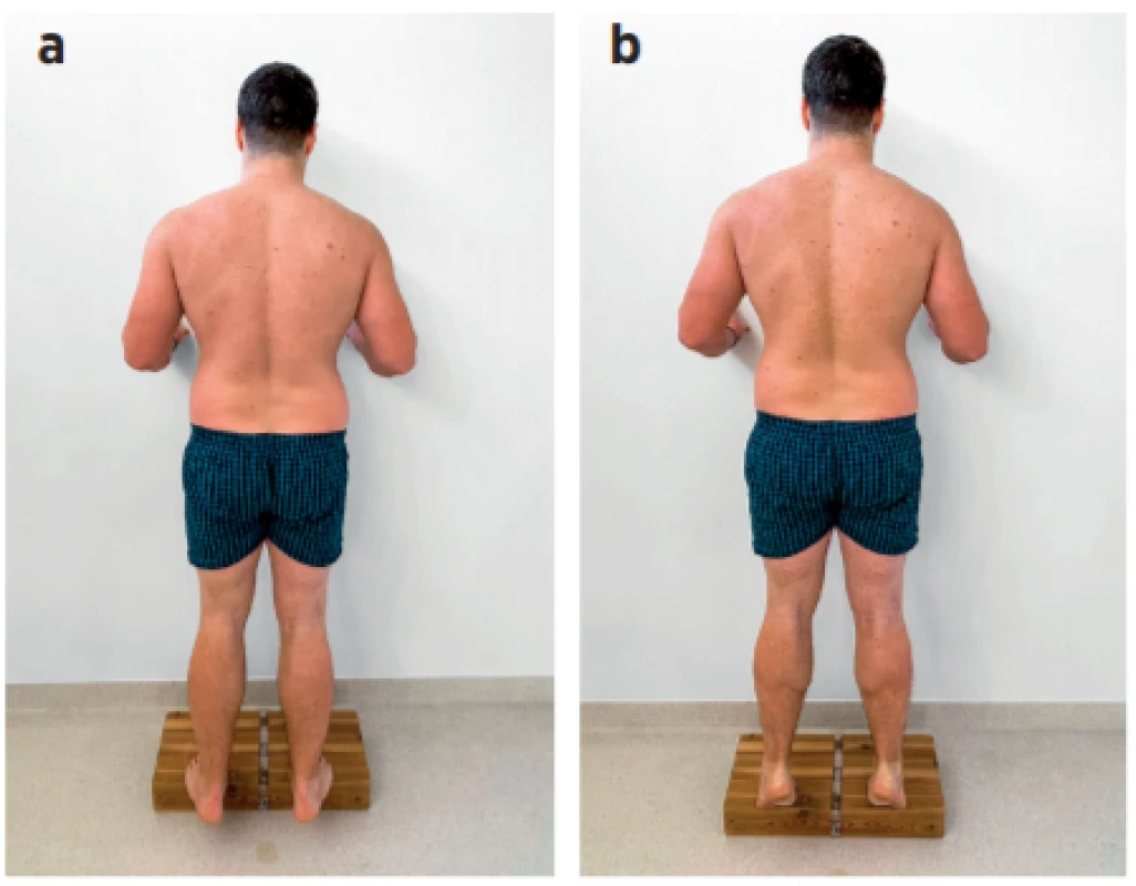a, b a) Výpony s cílem posilování mm. gastrocnemií, m.
soleus – výchozí pozice. b) Výpony s cílem posilování mm. gastrocnemií, m. soleus – provedení výponu.