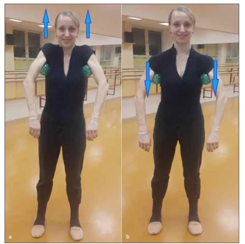 a,b. a) Cvičení s Franklinovými míčky – zvedání ramen, b) cvičení
s Franklinovými míčky – uvolňování ramen.<br>
Fig. 5a,b. a) Exercise with Franklin balls – raising shoulders, b) exercise with
Franklin balls – releasing shoulders.