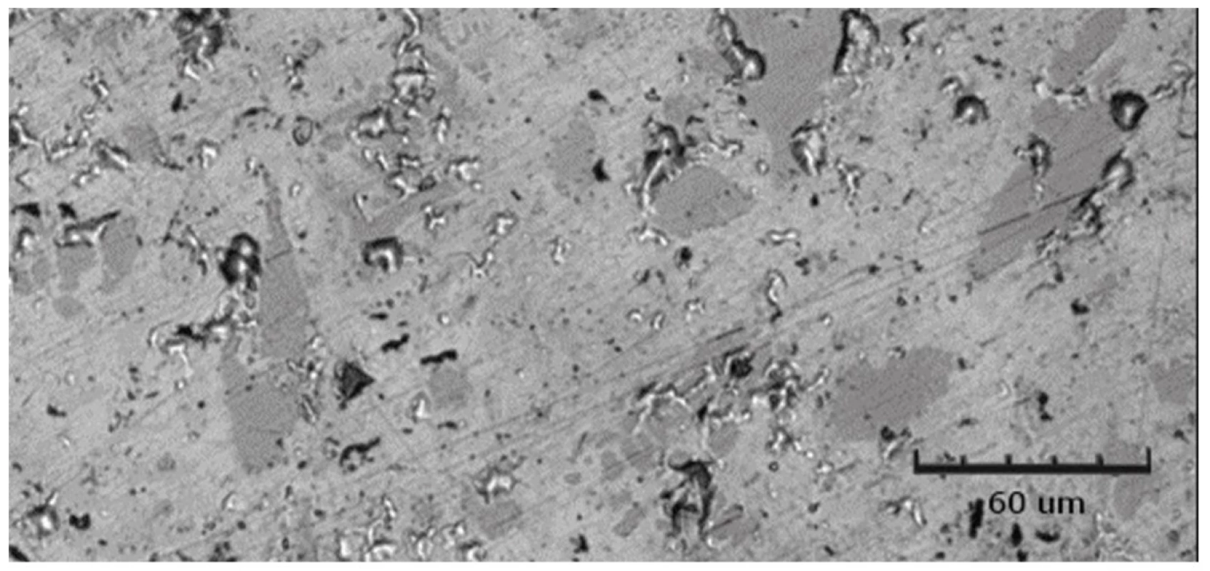 Kontrolní vzorek amalgámu ve vodě, zobrazeno CLSM<br>
Fig. 19 Amalgam control sample in water, shown by CLSM