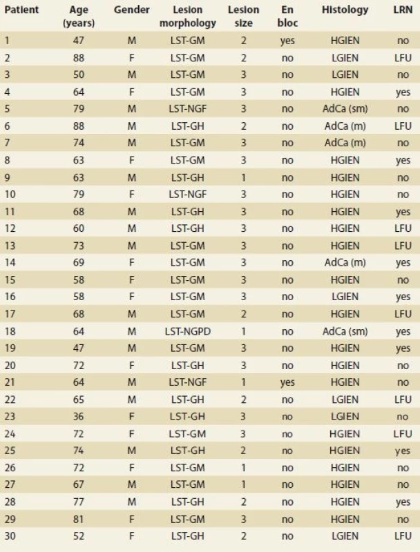 Endoscopic mucosal resection – basic demographic and clinical data.<br> Tab. 2. Endoskopická slizniční resekce – základní demografické a klinické charakteristiky.