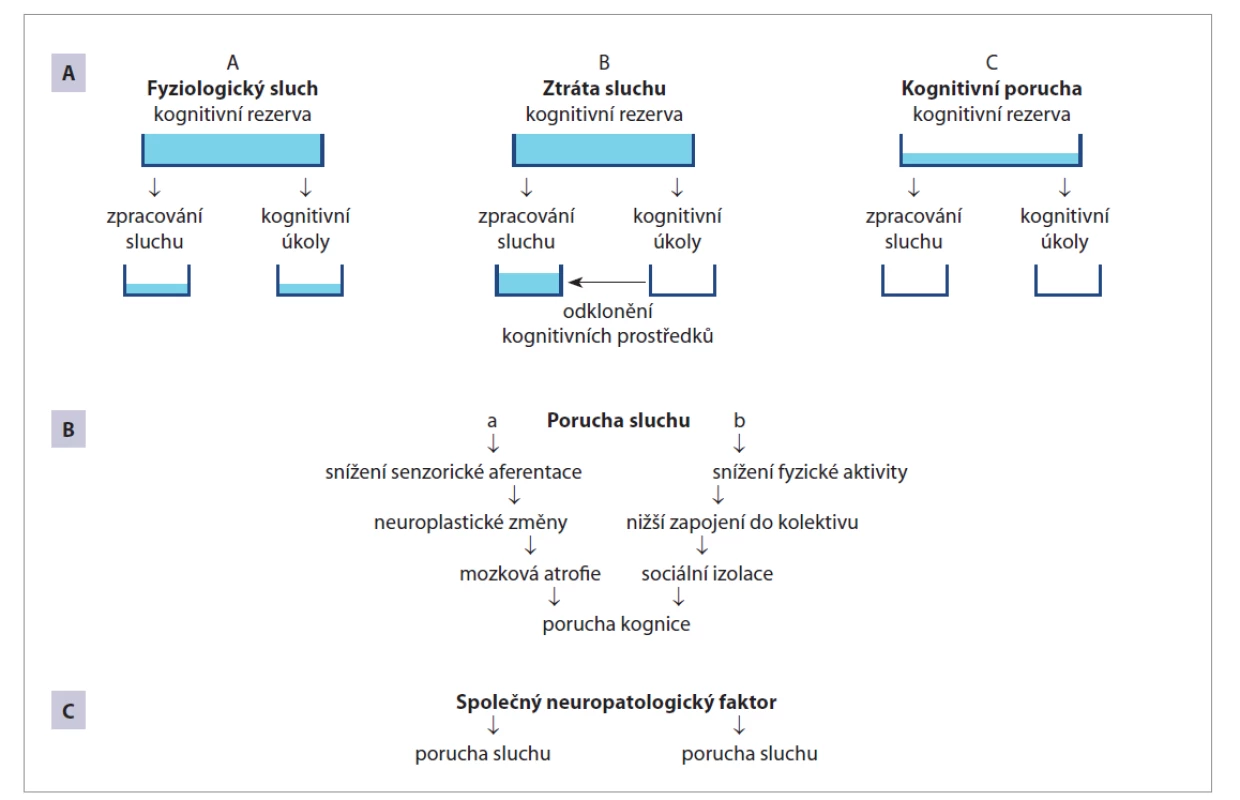 Potenciální mechanismy vztahu ztráty sluchu a poruchy kognice (upraveno podle Uchida et al. [50]).<br>
A) Teorie kognitivní nálože, (a) situace za fyziologických podmínek; (b) ztráta sluchu vede k nutnosti alokace většího množství
kognitivních prostředků směrem ke zpracování sluchu, čímž zbývá menší množství kapacity k jiným kognitivním úkolům;
(c) v případě primární poruchy kognice dochází k horšímu zpracování sluchu i horšímu kognitivnímu výkonu.<br>
B) Teorie kaskády je spojením (a) teorie senzorické deprivace, kde dochází k morfologickým změnám důsledkem nižší
senzorické aferentace a (b) teorie behaviorálního výkonu, kde důsledkem poruchy sluchu dochází k sociální izolaci
a následné poruše kognice.<br>
C) Teorie společného faktoru. Společný neuropatologický faktor je zodpovědný nezávisle na poruše sluchu i poruše
kognitivních funkcí.<br>
Fig. 1. Potential mechanisms of the relationship between hearing loss and cognition disorders (adapted from Uchida et al. [50]).<br>
A) Cognitive load on perception, (a) situation under physiological conditions; (b) hearing loss leads to the need to allocate
more cognitive resources toward hearing processing, leaving less capacity for other cognitive tasks; (c) in the case of a primary
cognition disorder, there is poorer hearing processing and poorer cognitive performance.<br>
B) Cascade theory is a combination of (a) the theory of sensory deprivation, where morphological changes occur due to lower
sensory afferent, and (b) the theory of behavioral performance, where hearing loss results in social isolation and subsequent
cognition impairment.<br>
C) Common cause theory. The common neuropathological factor is responsible independently of both hearing and cognitive
impairment.