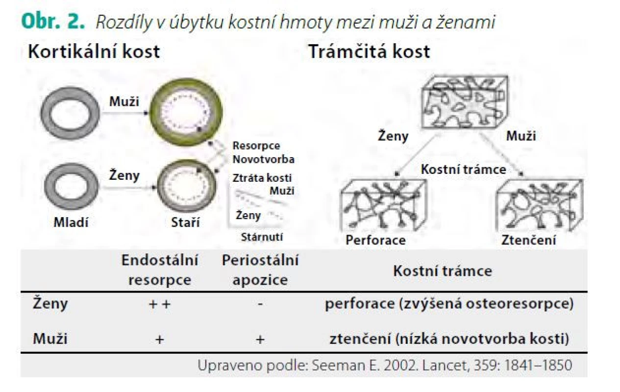 Rozdíly v úbytku kostní hmoty mezi muži a ženami