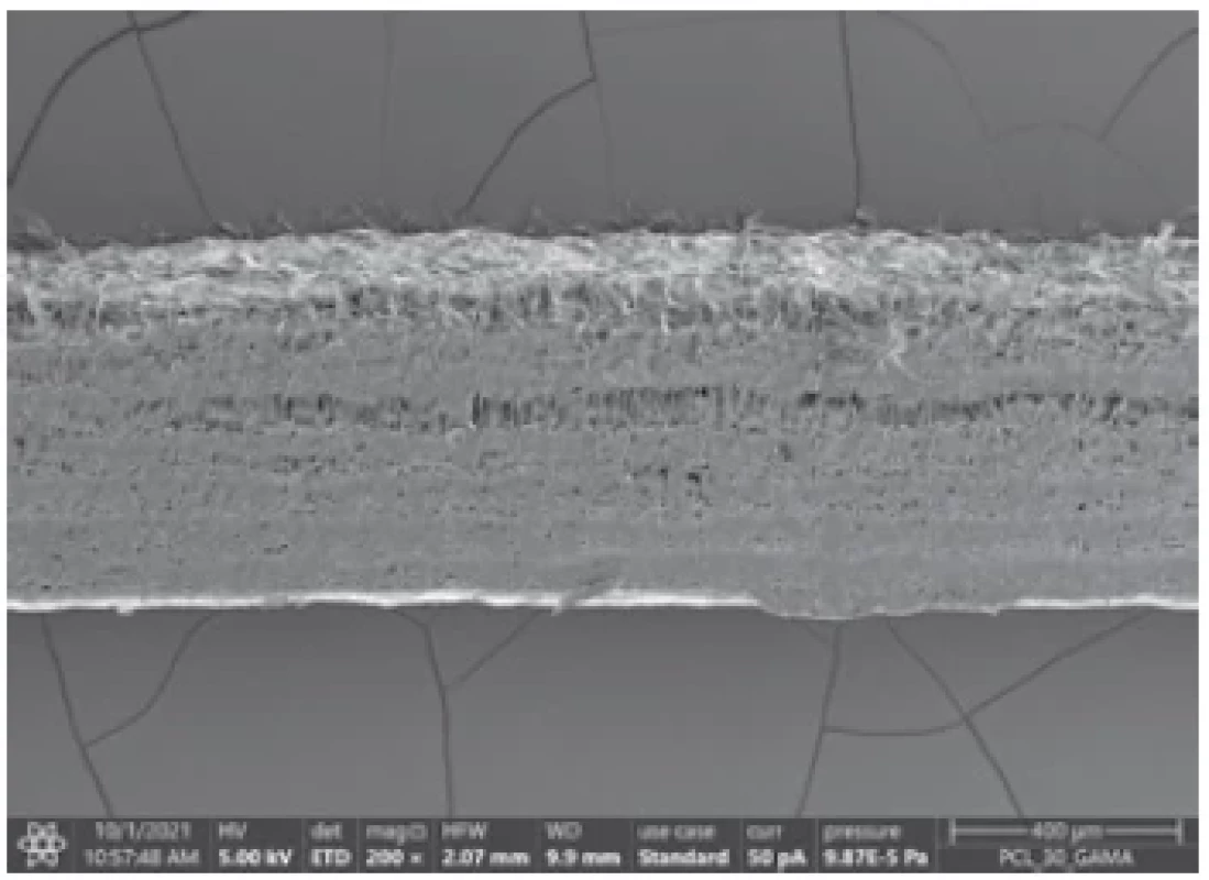 Representative scanning electron microscopy
(STEM Apreo S LoVac, ThermoFisher Scientific, USA)
image of composite banding (mag. 200×)