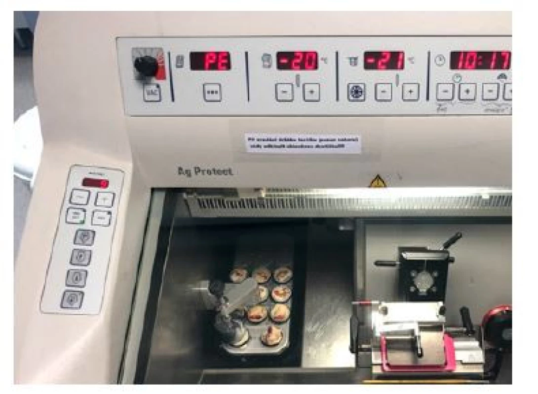 Připravené vzorky v kryostatu před krájením<br>
Fig. 5. Prepared samples in cryostat before slicing