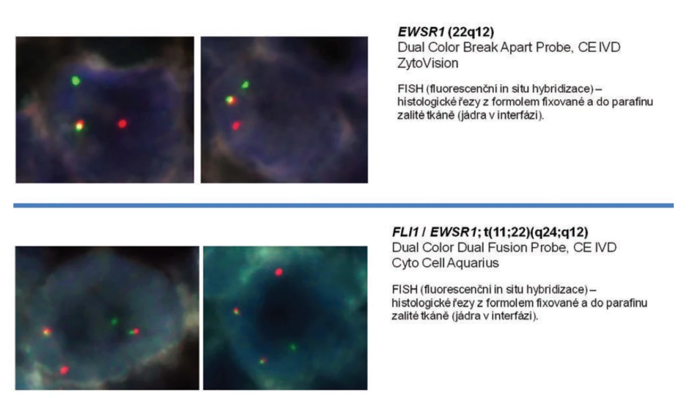 Interphase fluorescence in situ hybridization analysis