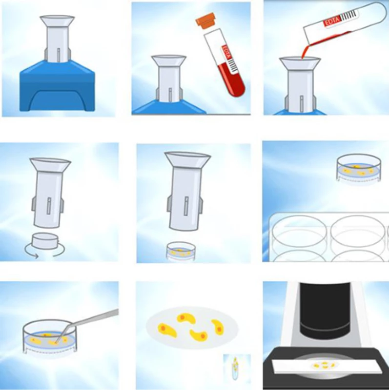 Metacell separační
aparát a schéma separace<br>
Fig. 1. The MetaCell separation device and the separation
scheme