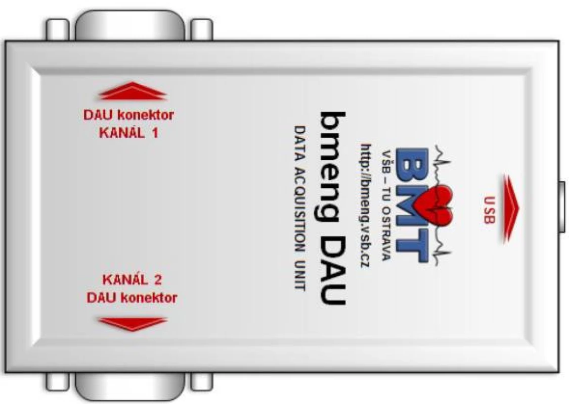 Data acquisition unit (DAU).
