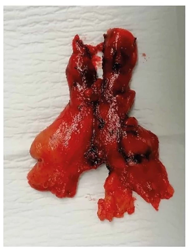 Thymus<br>
Fig. 6: Thymus