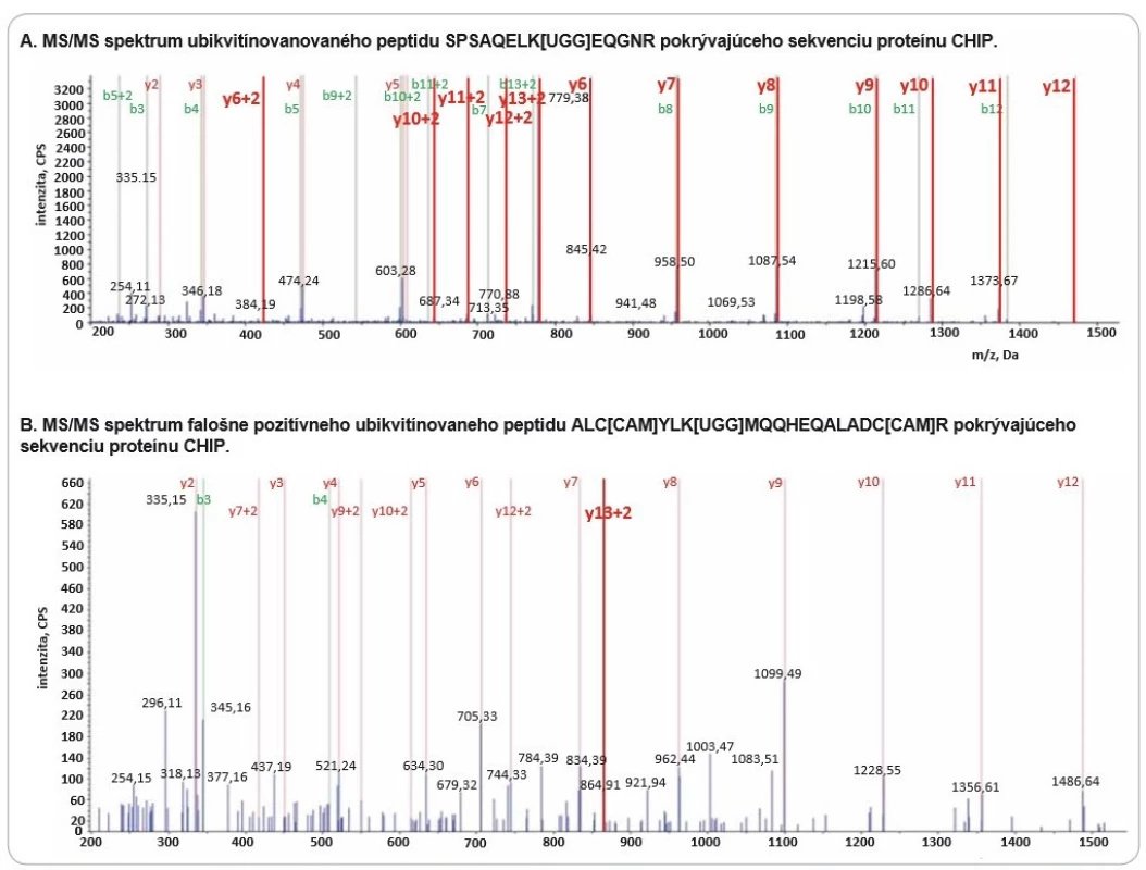 Fragmentačné spektrum peptidu SPSAQELK[UGG]EQGNR (A) a fragmentačné spektrum peptidu ALC[CAM]YLK[UGG]MQQHEQALADC[
CAM]R (B) so zvýraznenými produktovými iónami potvrdzujúcimi prítomnosť GlyGly modifi kácie na lyzíne. Fragmentačné
spektrum A naznačuje, že Lys8 nesie GlyGly zbytok ubikvitínu. V produktových iónoch y6–y12 dochádza k charakteristickému posunu
m/z o +114 Da (GlyGly zbytok). Rovnaký posun m/z možno sledovať aj v b sérii produktových iónov (b8–b12) indikujúci prítomnosť
GlyGly zbytku ubikvitínu. Fragmentačné spektrum B obsahuje len jeden produktový ión potvrdzujúci modifi káciu GlyGly.
Ubikvitinácia peptidu ALC[CAM]YLK[UGG]MQQHEQALADC[CAM]R nebola potvrdená, keďže jediný charakteristický produktový ión
s posunom +114 Da môže pochádzať z iného kofragmentovaného prekurzorového iónu.