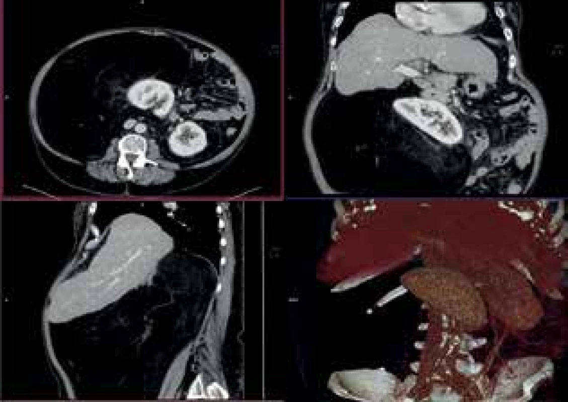 CTA vyšetření<br>
Fig. 2: CTA examination
