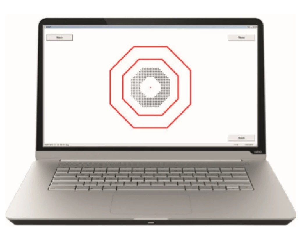 Test interface upon testing of metamorphopsias in D Chart program