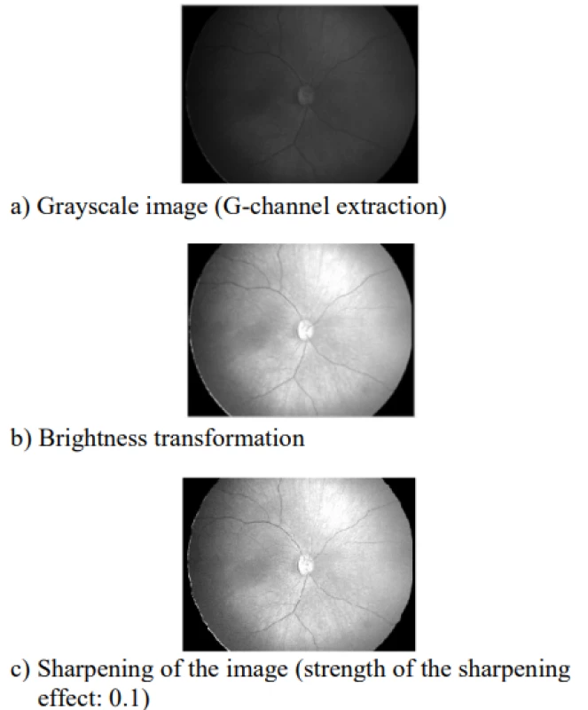 First part of preprocessing image: a) image in
grayscale, b) brightness transformation, c) sharpening
of the image with parameter strength of the sharpening
effect 0.1.