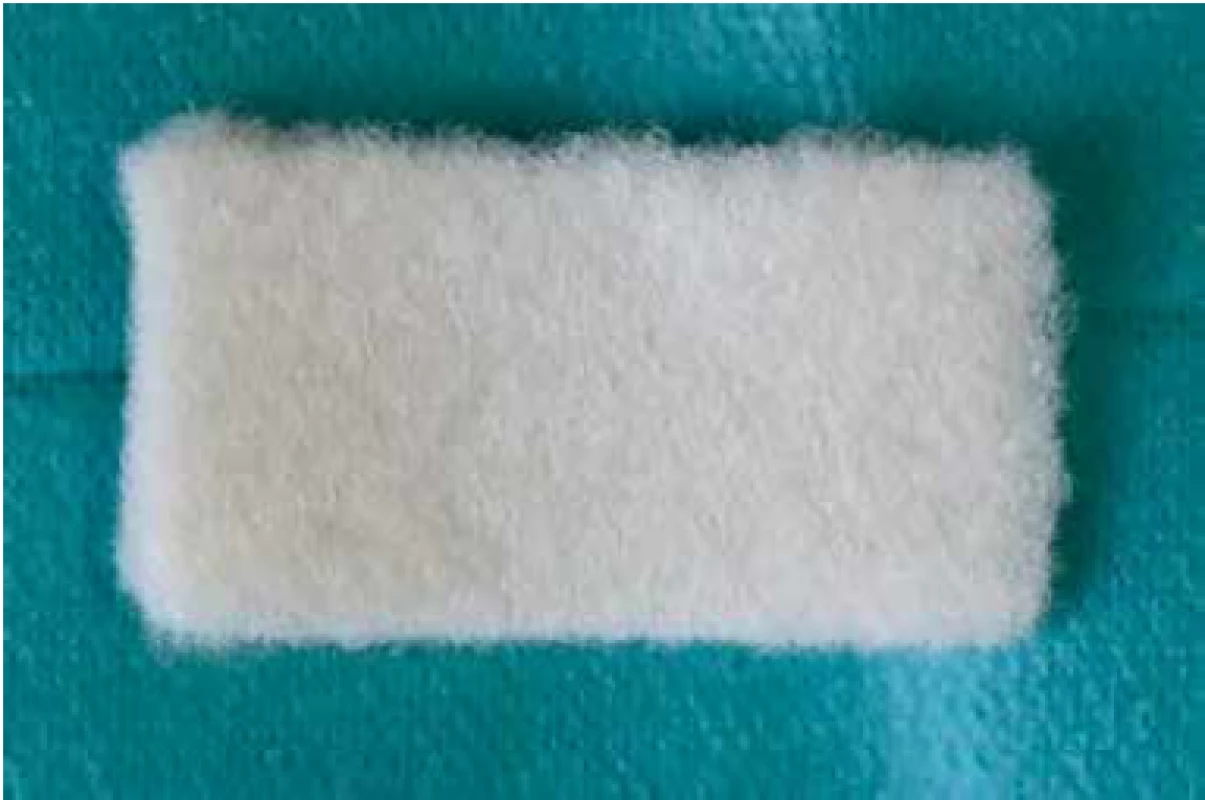 Surgicel® FibrillarTM Absorbable Hemostat. Zvyšky v operačnom poli môžu vyvolať zápalový pseudotumor s napodobením recidívy pôvodného nádoru.