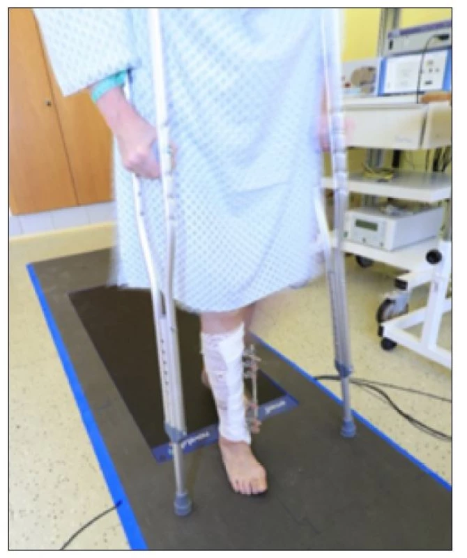 Vyšetření pacienta na plantografické plošině při pooperační rehabilitaci