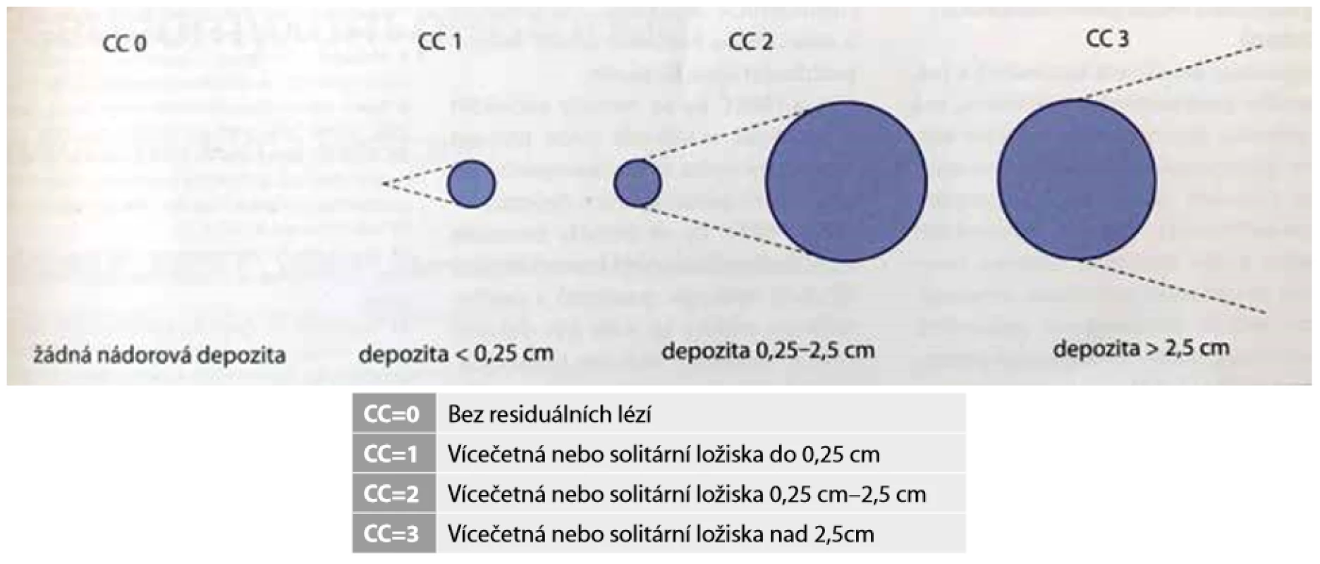  CC skóre (0−3) je určeno dle velikosti zbylých solitárních ložisek po provedené cytoreduktivní chirurgii (CRS) <br>Fig. 3: CC score (0−3) is determined by the presence of the remaining residual tumorous lesions after cytoreductive surgery (CRS)