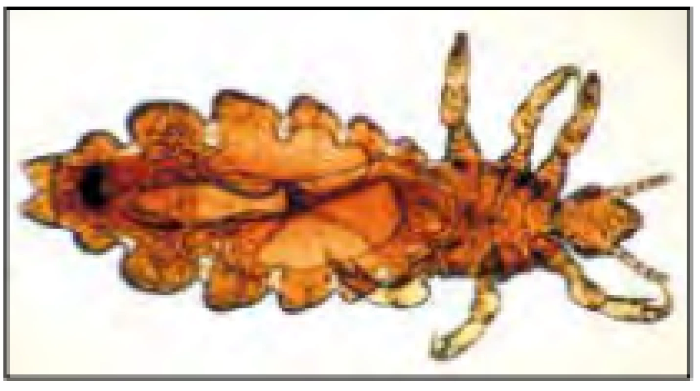 Pediculus humanus capitis (veš hlavová dětská). Tělo a hlava vši jsou přibližně 1 až 3 mm dlouhé
a jsou zploštělé dorzoventrálně. [Převzato od Centra pro
kontrolu nemocí a Preventivní laboratorní identifikace
parazitů v oblasti veřejného zdraví; Ministerstvo zdravotnictví a sociálních služeb Spojených států amerických]