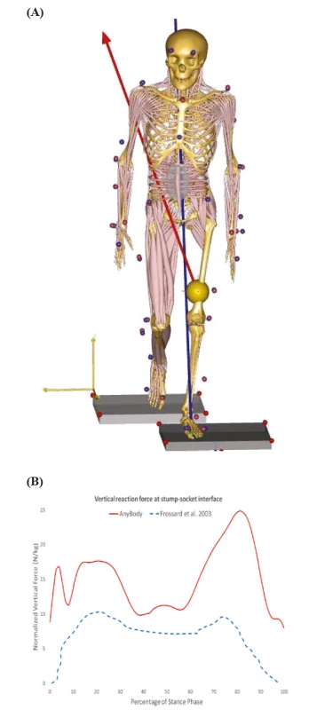 (A) AnyBody™ simulation during stance
phase for simulated amputee gait. (B) Bodyweight
normalized vertical reaction forces at the stump–socket interface. Solid line: current study; dashed line from [32].