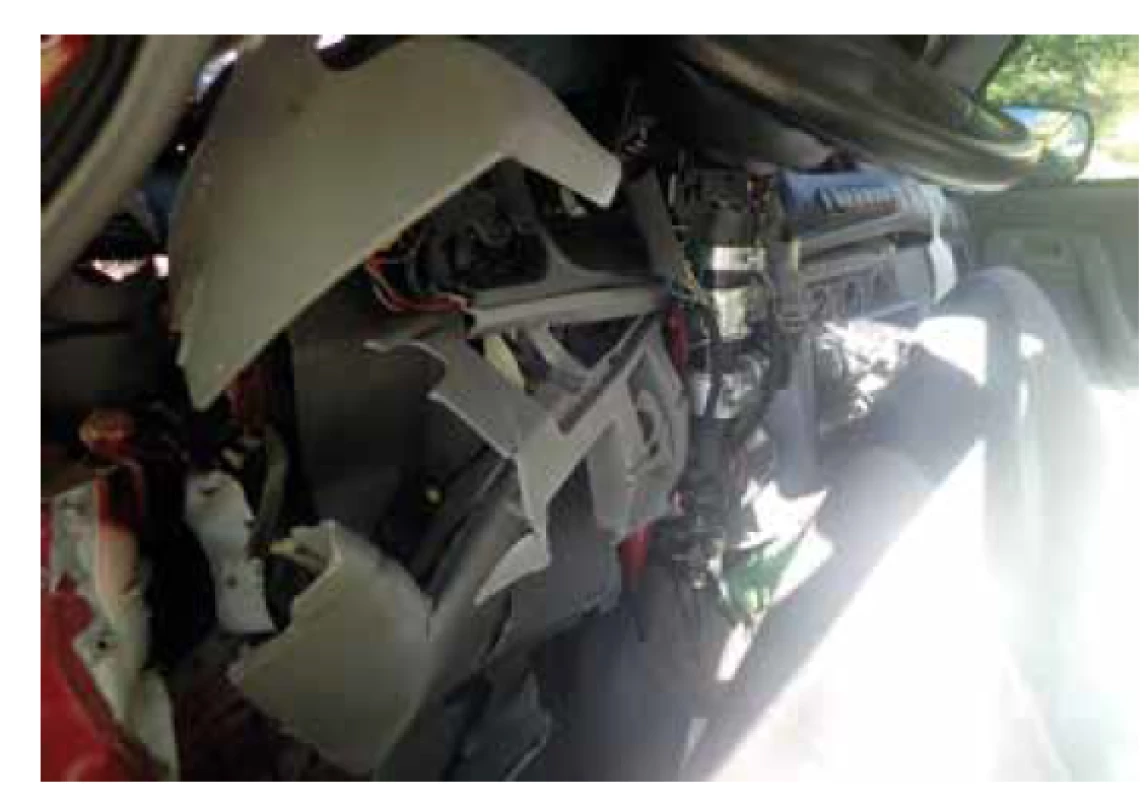 Ukázka deformace interiéru vozidla č. 1.<br>
Fig. 4. Illustration of the interior deformation of vehicle no. 1.