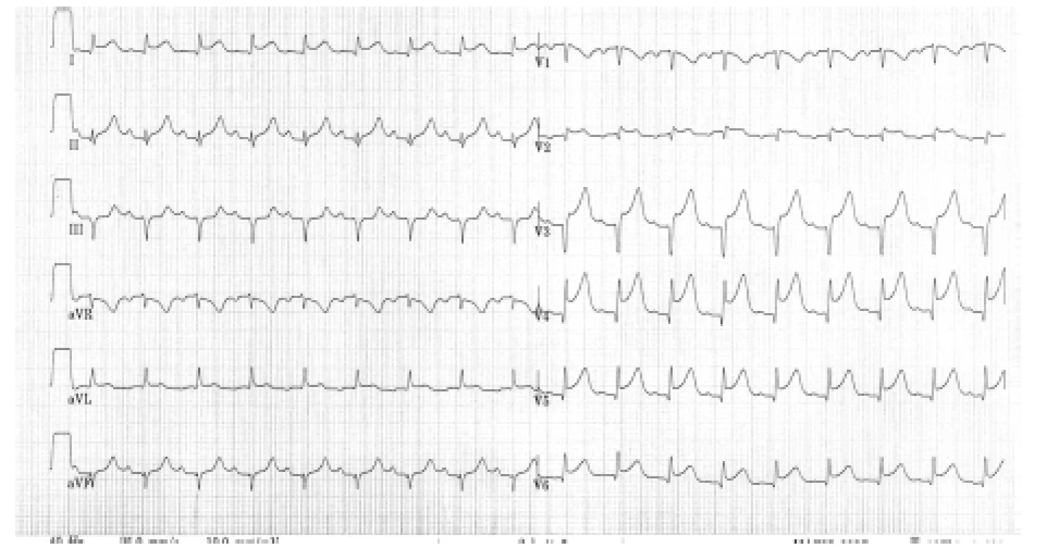EKG natočené přímo na operačním sále