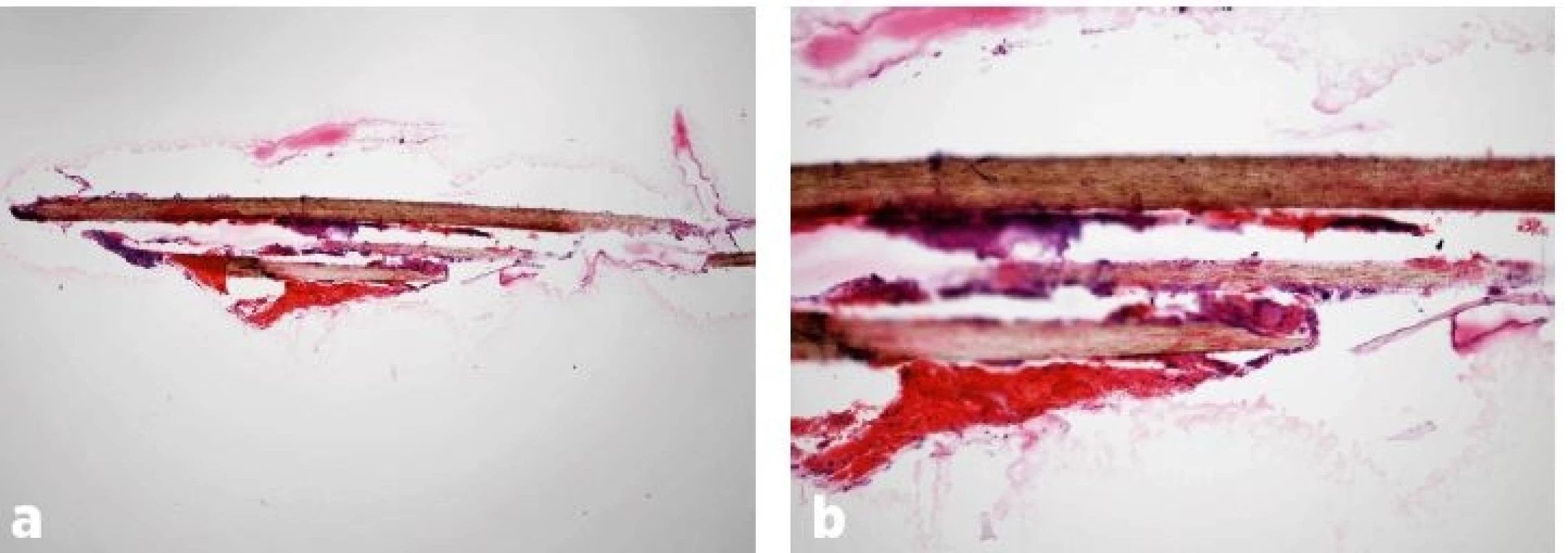 a, b. Histologický obraz lidského vlasu – přehledová mikrofotografie (x40, HE) (a), a detailní záběr téhož vlasu (x100, HE) (b). Foto prof. MUDr. J. Laco, Ph.D., Fingerlandův ústav patologie LF UK a FN v Hradci Králové