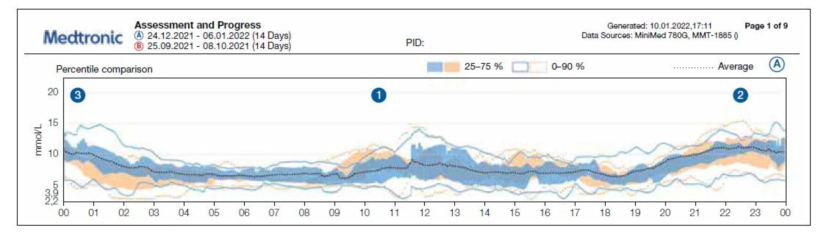 Příklad souhrnného zobrazení dat z pokročilého hybridního uzavřeného okruhu Minimed 780G (Medtronic, USA). Zobrazen je Ambulatory Glucose
Profile (AGP) ve dvou časových obdobích (modře a oranžově) pro snadnější porovnání pokroků v léčbě. [Obrázek z archivu autora]