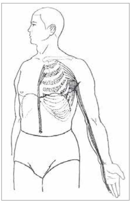 Šľachovo-svalová dráha srdca<br>
Fig. 9. Tendon-muscle path of the heart