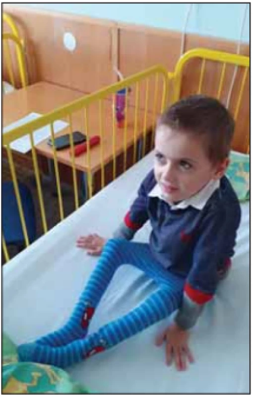 Chlapec se SMA II s poruchou
výživy.<br>
Fig. 7. A boy with SMA II and malnutrition.