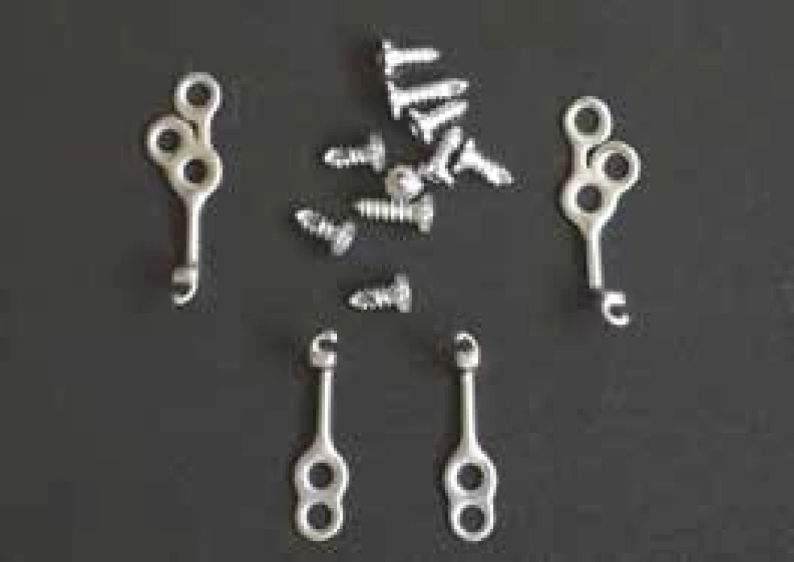 Skeletální miniplaty typu
Bollard s fixačními šrouby
– sada určená pro jednoho
pacienta<br>
Fig. 1
Bone anchored
Bollard miniplate with screws
– one pacient set