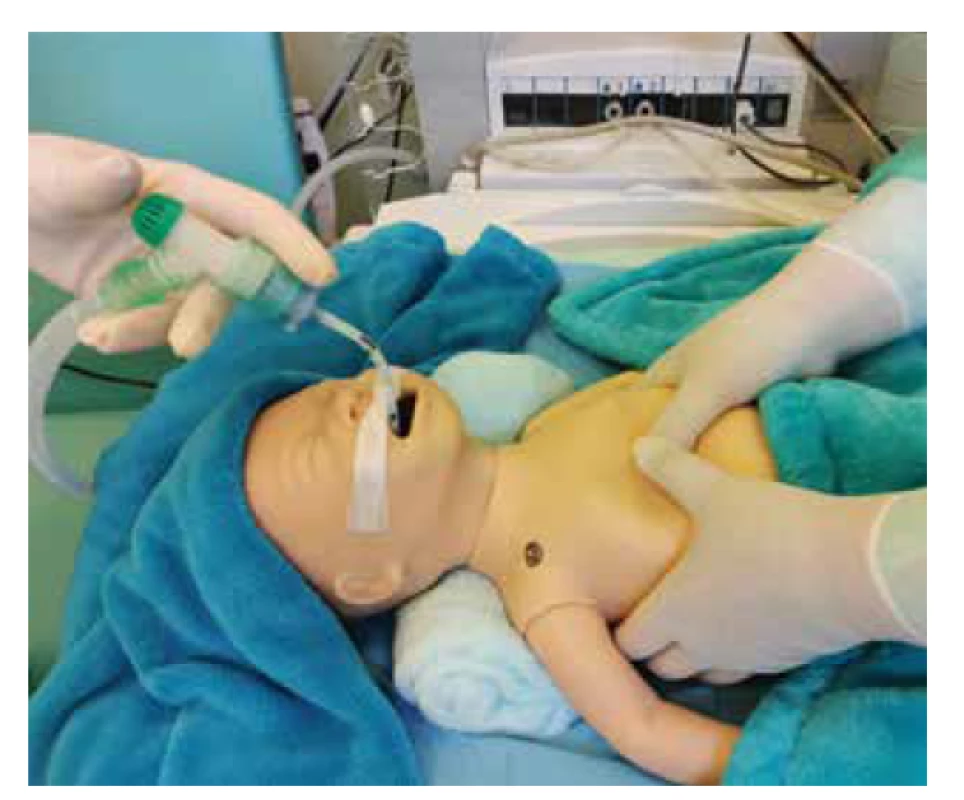 Zevní srdeční masáž (palce přes sebe).<br>
Fig. 7. Chest compression (overlapping the thumbs).