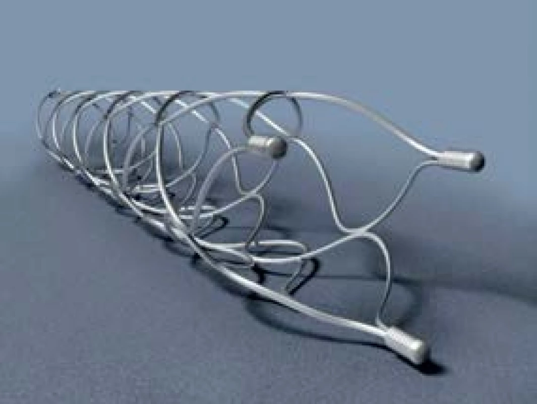 Stent-retriever Solitaire