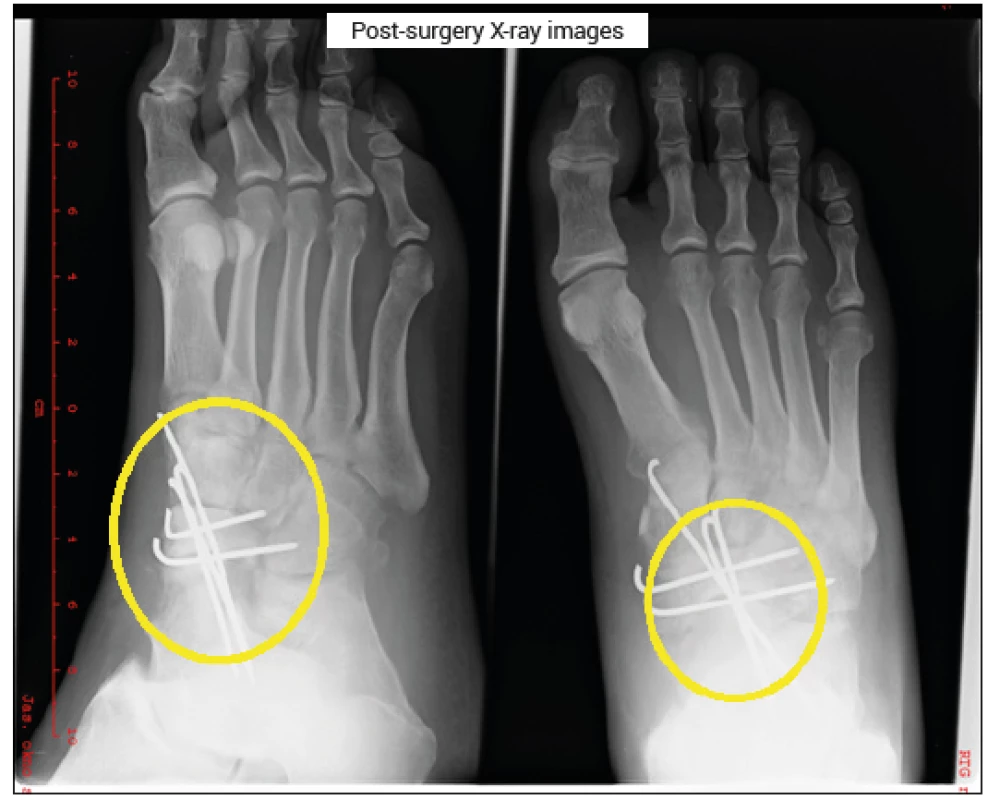 Post-surgery X-ray Images (Sedlář Archive)