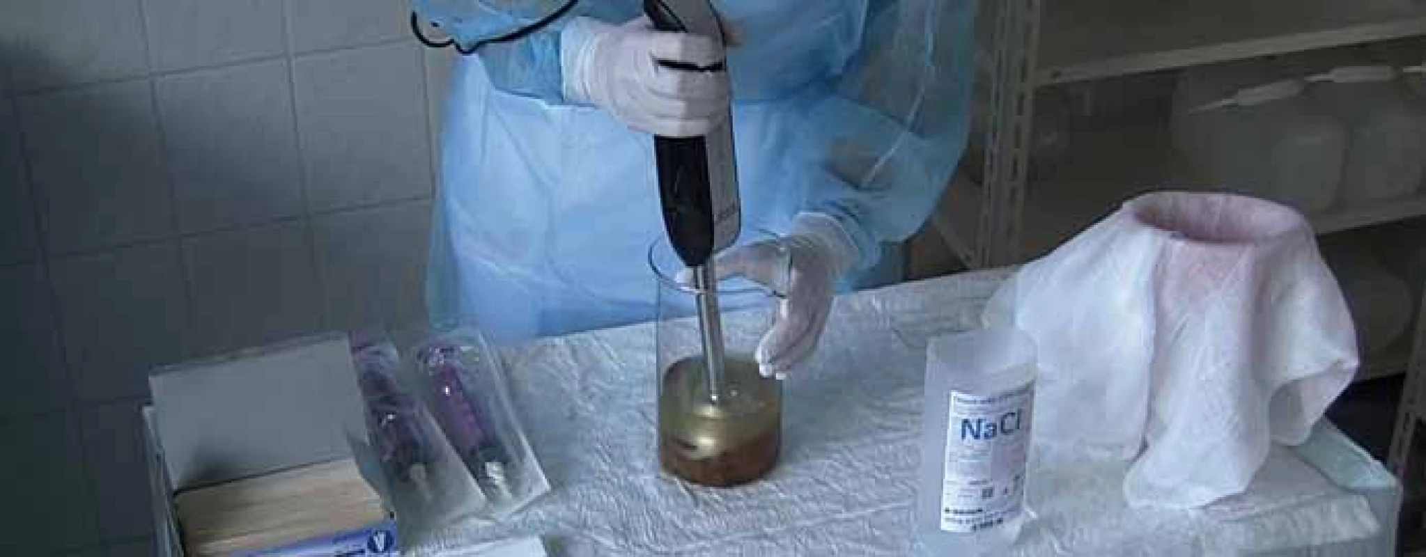 Příprava fekálního transplantátu – homogenizace stolice.<br>
Fig. 1. Preparation of faecal transplant – faecal homogenisation.