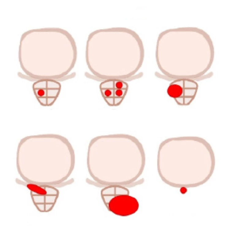 Molecular Imagine Tumor klasifikace; převzato z (14)<br>
Fig. 1. Molecular Imagine Tumor classification