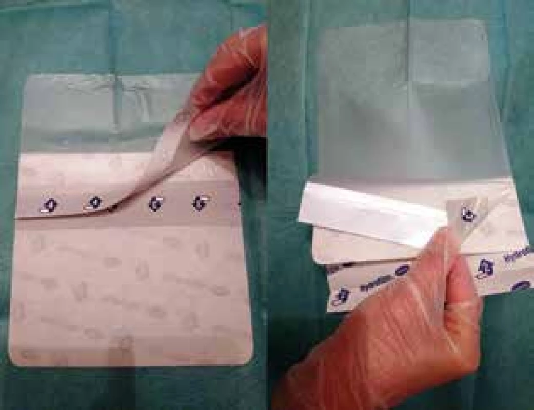 Manipulace s folií <br>Fig. 9: Drape handling
