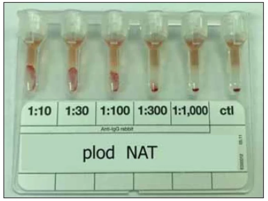 Kvantifi kace IgG protilátky v plazmě plodu
(DAT IgG-Dilution BioRad, Cw–Kk).