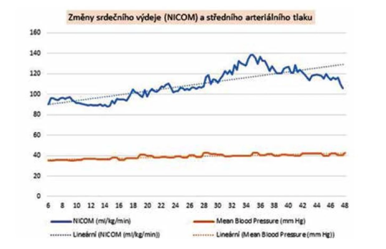 Kontinuální měření srdečního výdeje pomocí bioreaktance u novorozenců
s porodní hmotností pod 1250 gramů (změny srdečního výdeje v prvních 48 hodinách)
[10]
