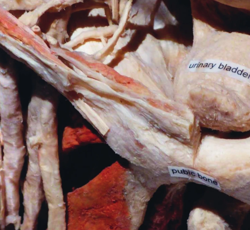 Uložení močového měchýře v ženské malé pánvi (vlastní foto, výstava Body Worlds., Amsterdam, 2016).