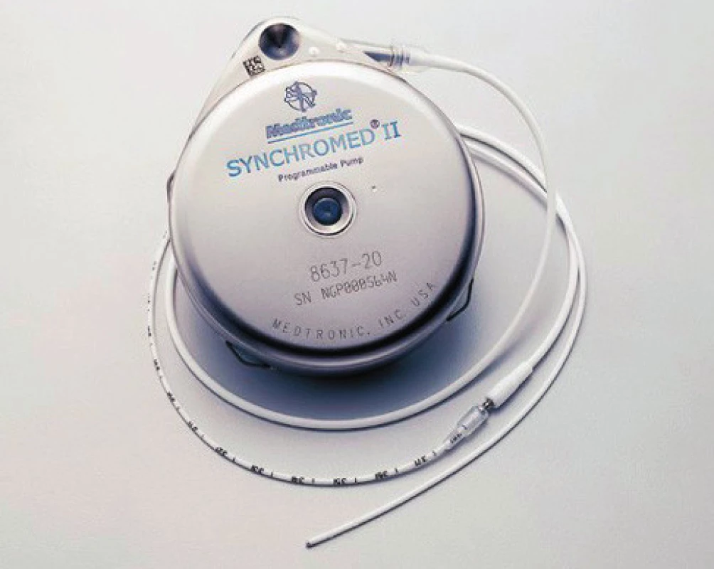 Pumpa Synchromed II 40 ml pro s.a. aplikaci léků
(materiál Medtronic)