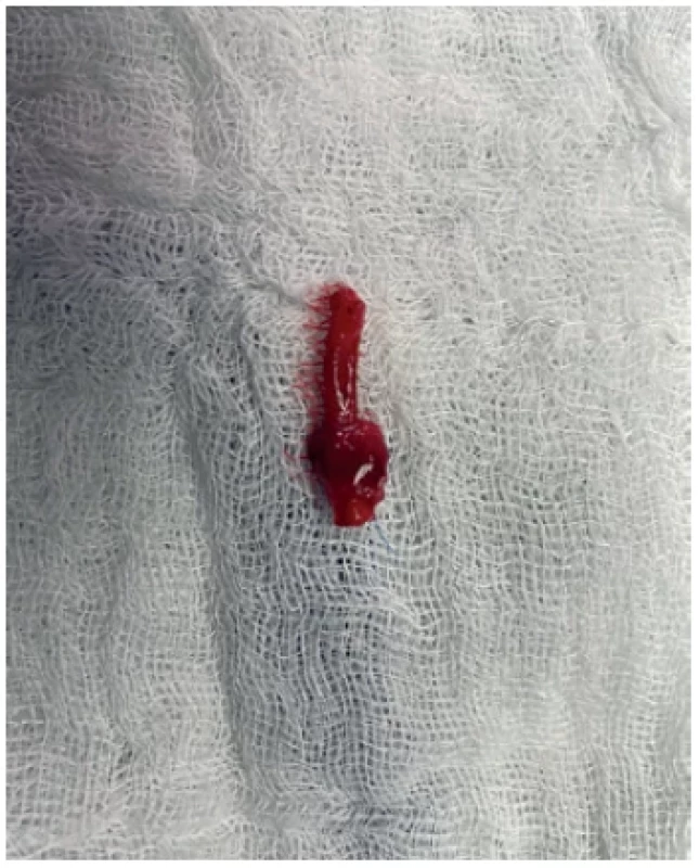 Explanted rabbit abdominal aorta with the arterial
band
