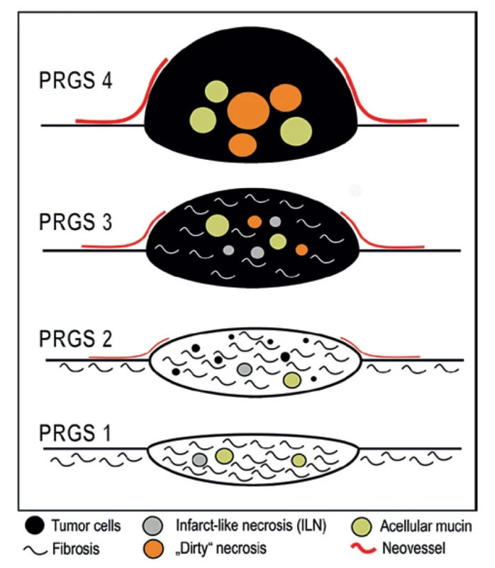 Grafické znázornění PRGS [8]<br>
Fig. 3: Schematic illustration of PRGS [8]