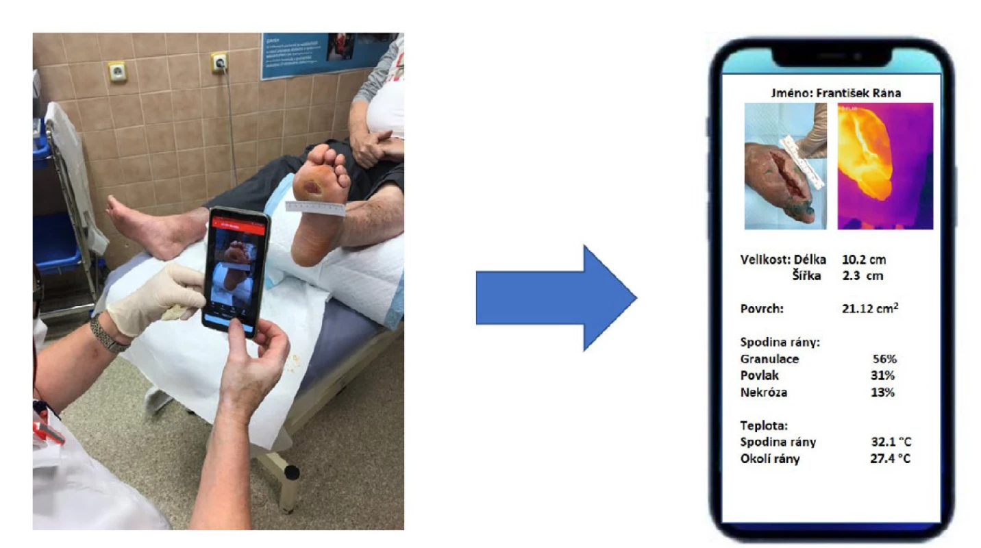 Příklad ideálního automatického vyhodnocení rány včetně termografie pomocí mobilní aplikace.