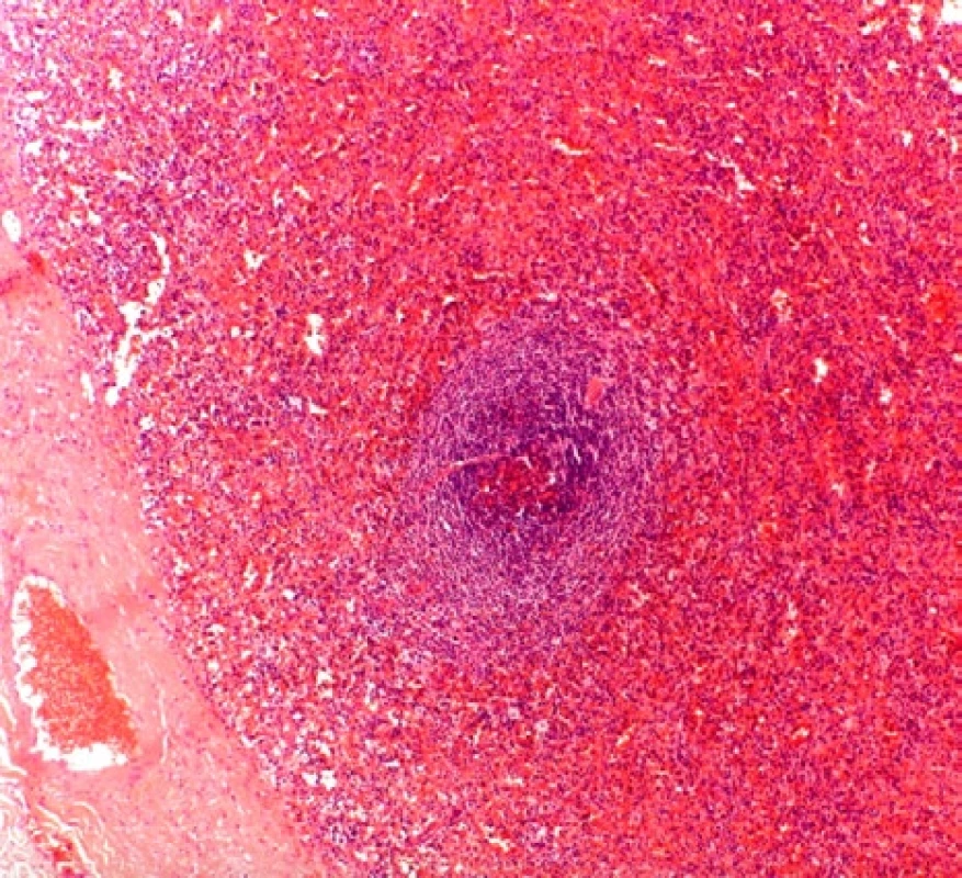 Histologický nález II