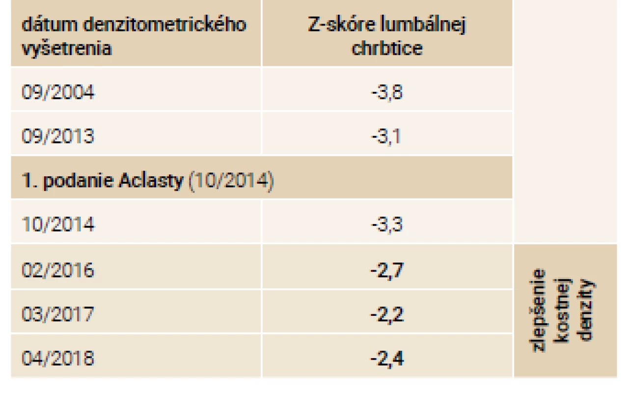 Vývoj denzitometrických nálezov –
pacient-brat