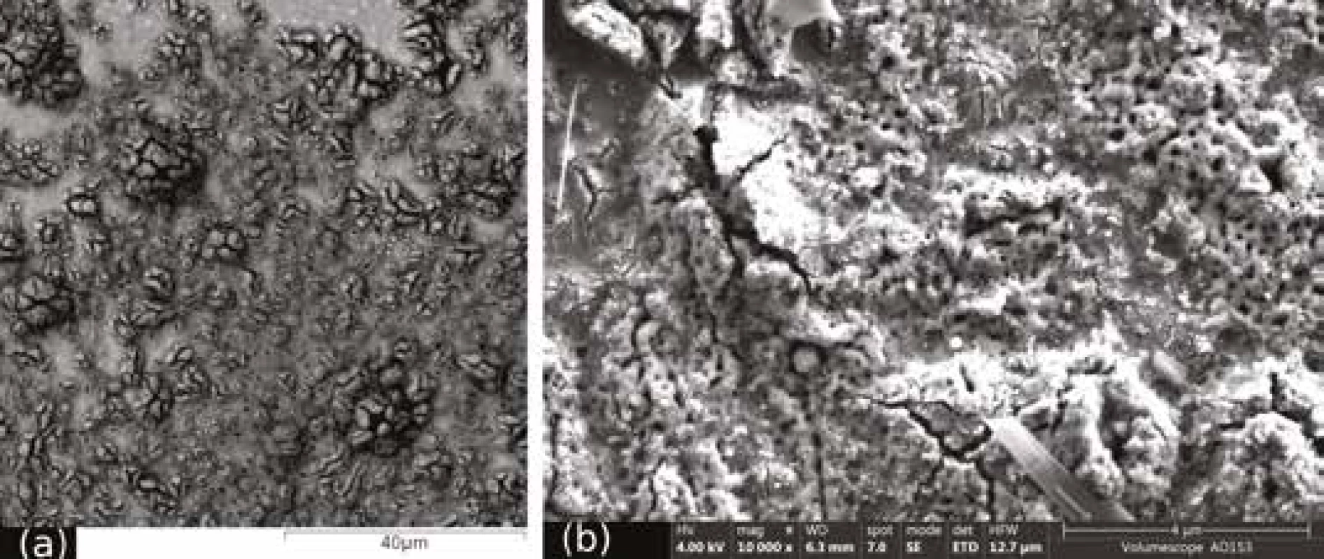 Defekty
anodizovaného povrchu,
přehled (a) a detail (b)<br>
Fig. 3
Defects of anodized surface,
overview (a) and detail (b)