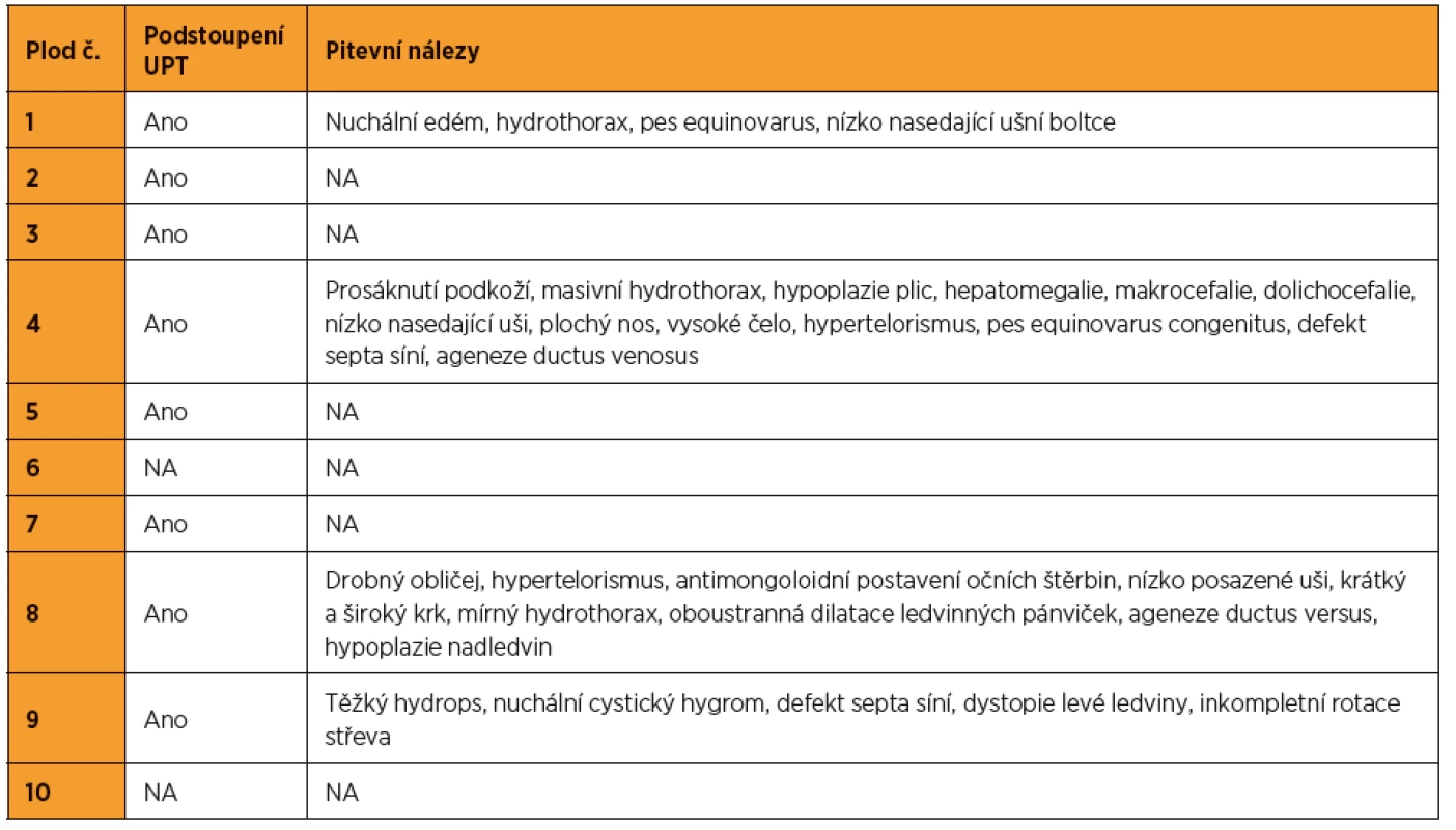 Patologicky-anatomické pitevní nálezy u plodů pozitivních na syndrom Noonanové (NA – není k dispozici)